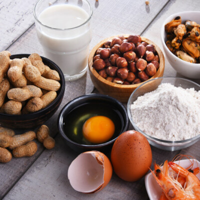 Nuts, fruit, milk, eggs and shellfish are a few common allergens.